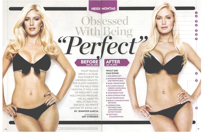 Heidi-Montag-Before-And-After